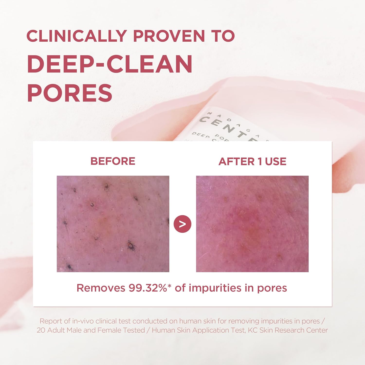 SKIN1004 Centella Poremizing Deep Cleansing Foam | Sebum Control & Pore Tightening with Kaolin & Papain for Oily Skin, 125ml